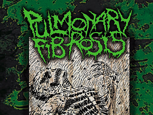 PULMONARY FIBROSIS – Nasal Nauseous Vomit Liquid Goregrind History Volume 2