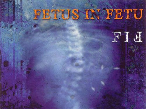 FETUS IN FETU &#8211; case report