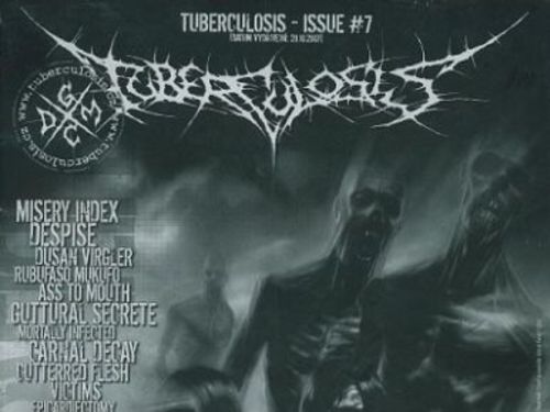 TUBERCULOSIS #7