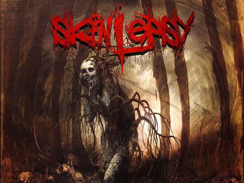 SKINLEPSY – Dissolved